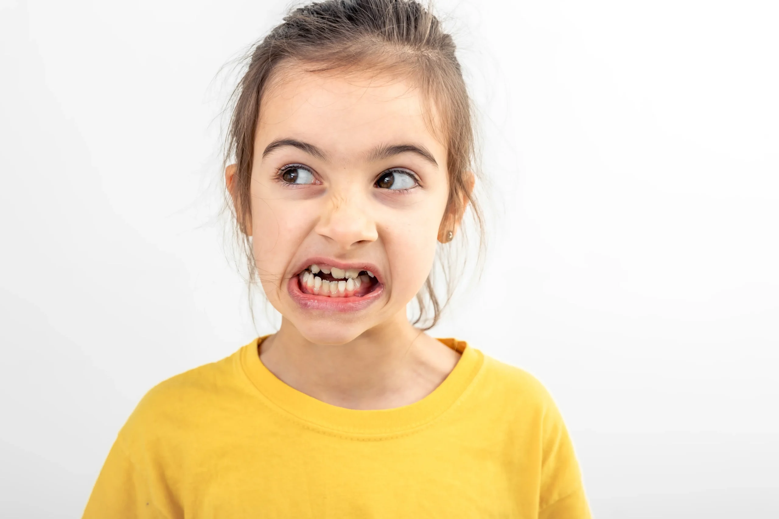 merapikan gigi anak berantakan