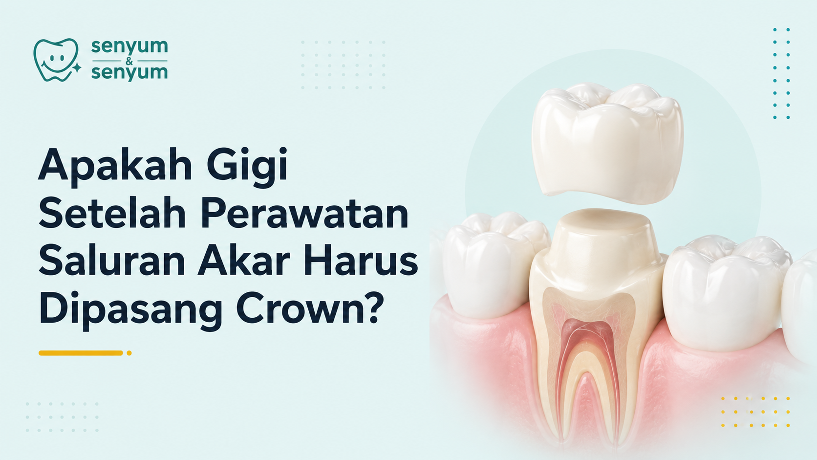 Apakah Gigi Setelah Perawatan Saluran Akar Harus Dipasang Crown?