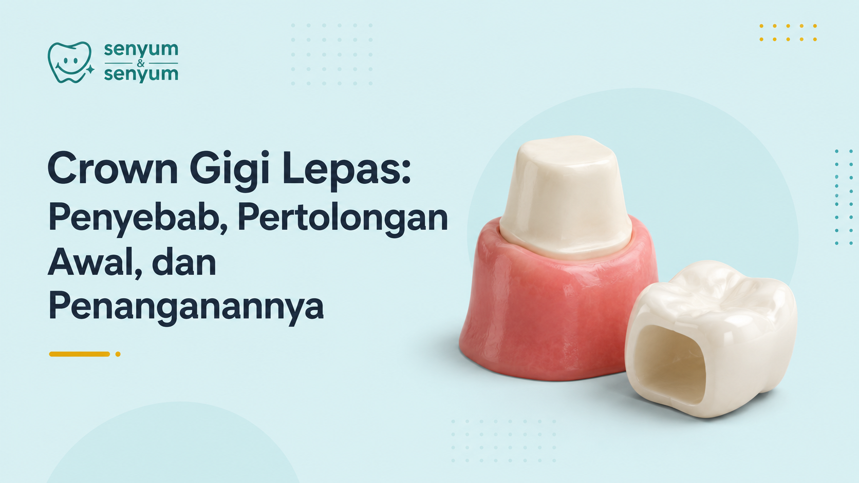 Crown Gigi Lepas: Penyebab, Pertolongan Awal, Penanganan