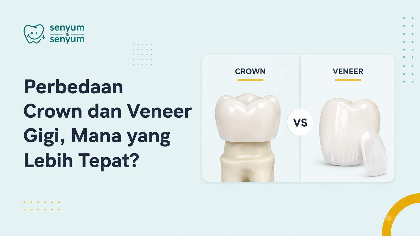 Perbedaan Crown dan Veneer Gigi, Mana yang Lebih Tepat?